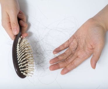 Vitamin Untuk Mengatasi Rambut Rontok Yang Bagus